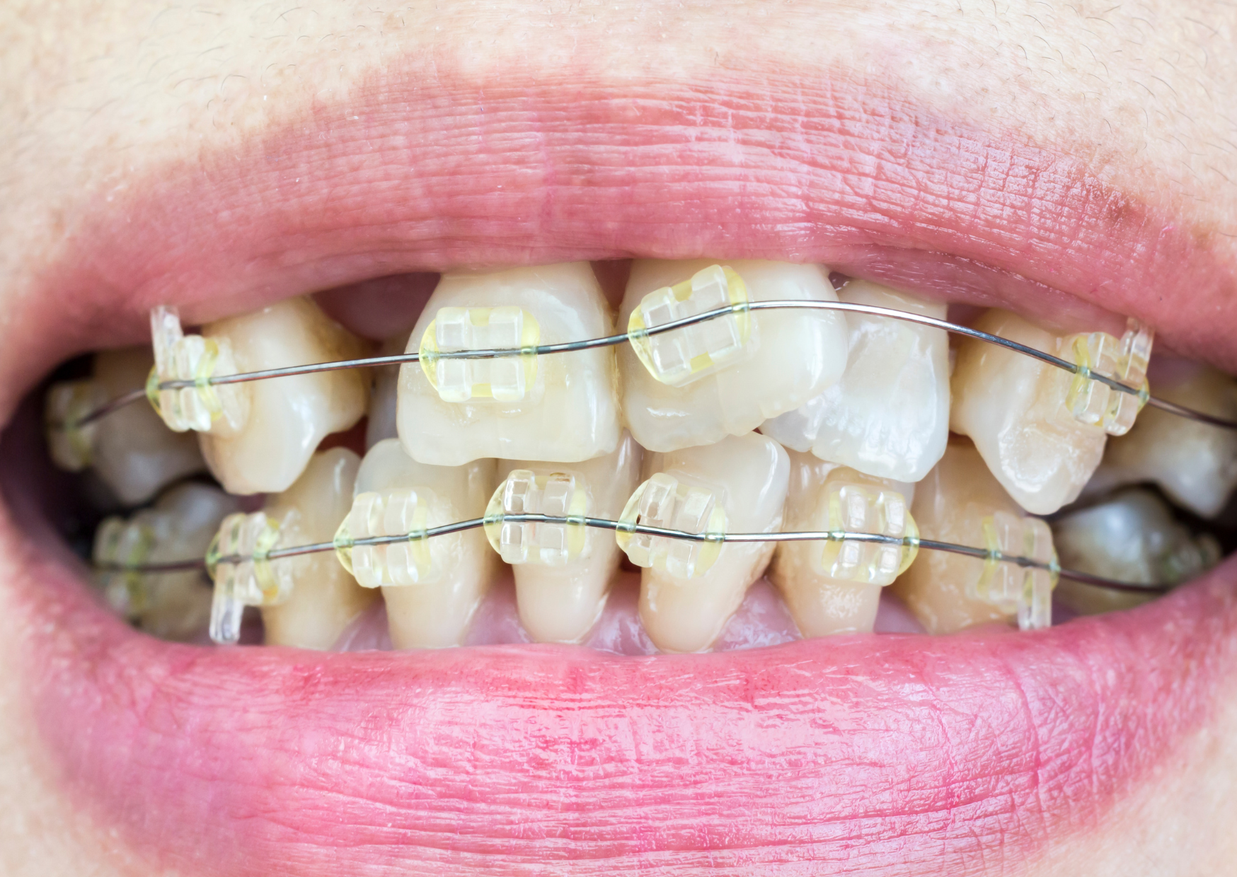 british teeth 7