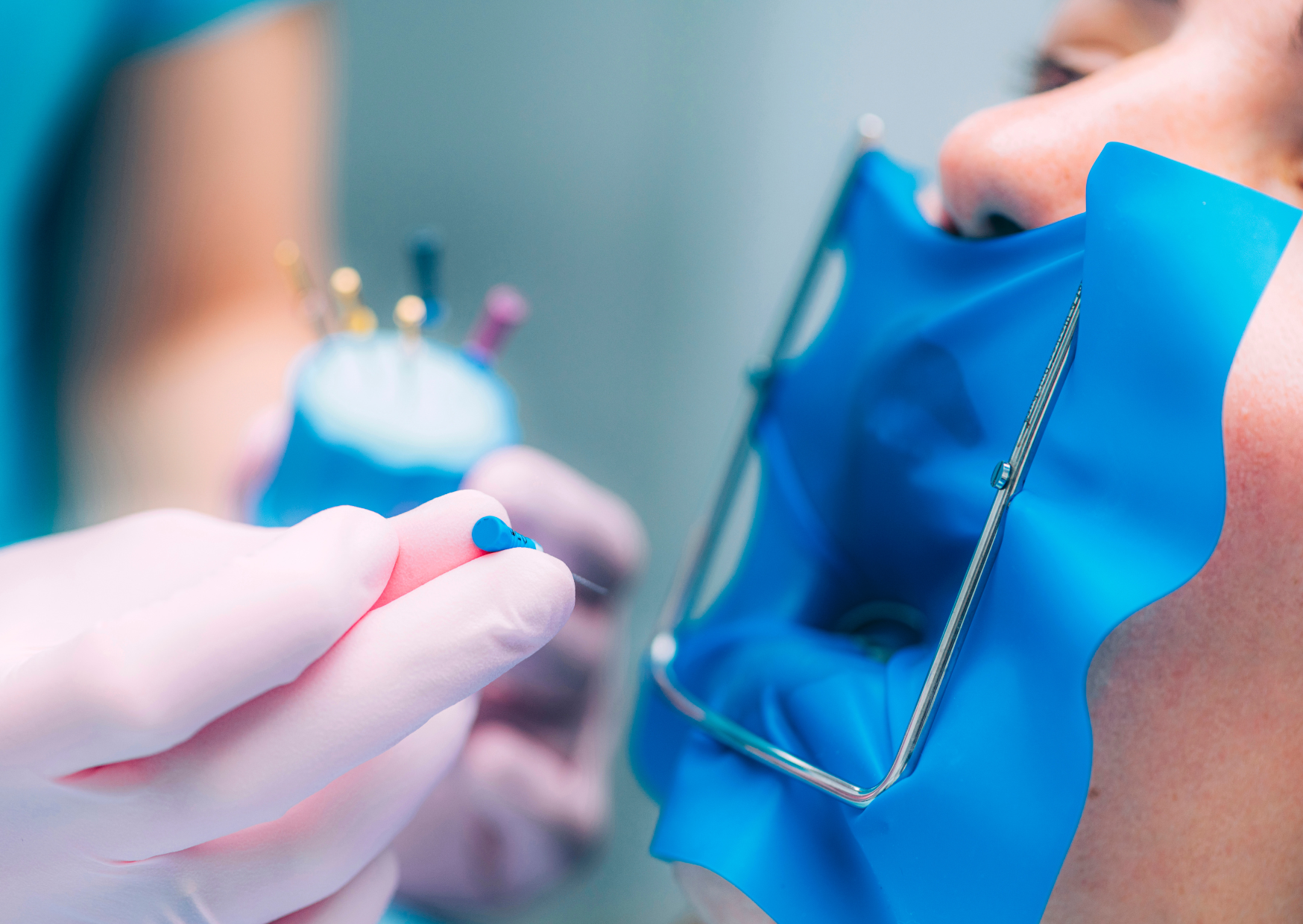root canal 5